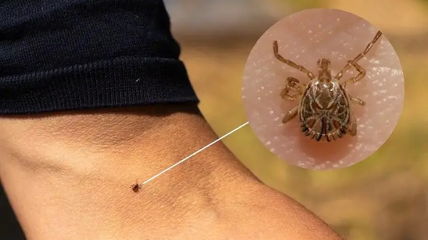 Primeiro óbito do ano por febre maculosa é confirmado em Campos
