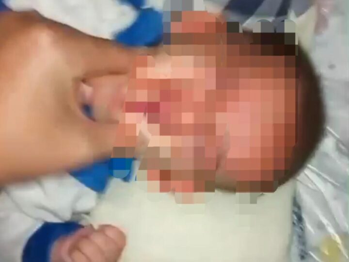 Bebê de 5 meses é acolhido após denúncia de maus-tratos em São João da Barra