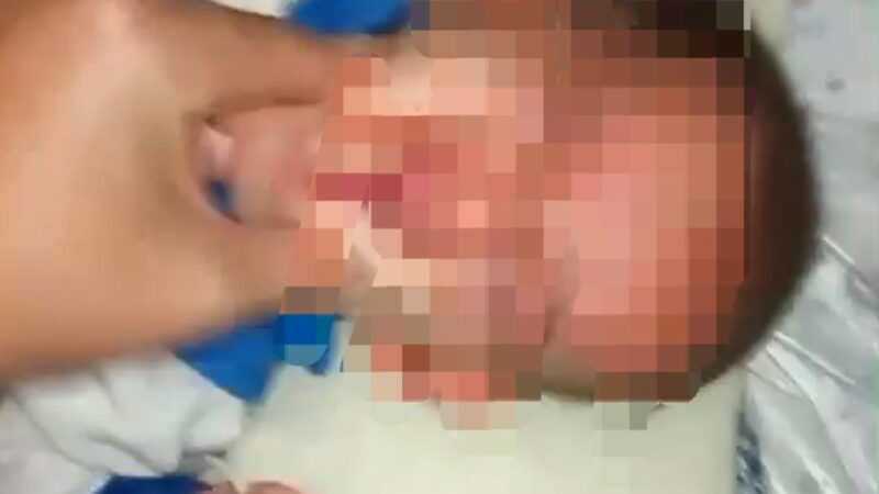 Bebê de 5 meses é acolhido após denúncia de maus-tratos em São João da Barra
