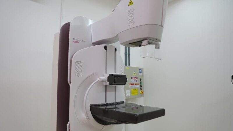 SJB contabiliza mais de 1.400 exames de mamografia